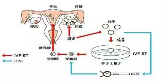 长春高龄孕妇